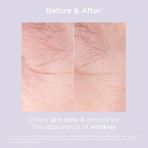Glicoisdin 15 Moderate Gel Exfoliante Para Rostro Con Ácido