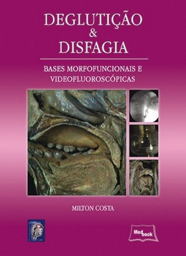 Deglutição E Disfagia, De Costa. Editora Medbook, Capa Mole Em Português