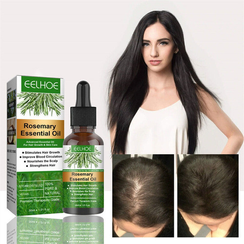 . Óleo De Alecrim Para Fortalecer Couro Cabeludo E Cabelo