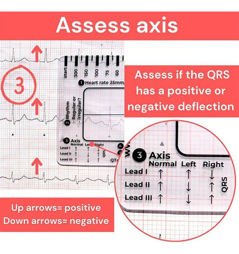 Regla De 7 Pasos Para Electrocardiogramas, Regla De Bolsillo