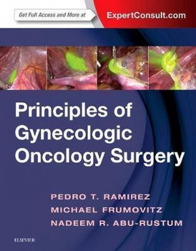 Principles Of Gynecologic Surgery