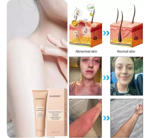 Quarxeri Purificante Exfoliante, Gel Exfoliante Avanzado 2 P