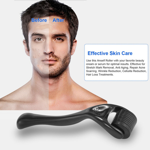 540 Derma Roller - Rodillo Para Barba (0,25 Mm, Titanio)