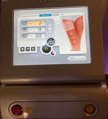 Imagen 5 de 5 de Curso Taller Depilacion Definitiva Laser Certificado