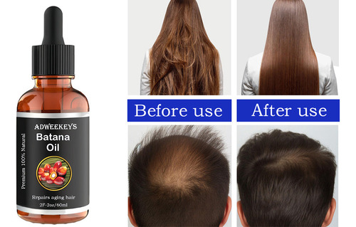 , Aceite For El Crecimiento Del Cabello, 3 Unidades, 60 Ml A