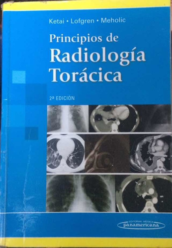 Principios De Radiología Torácica