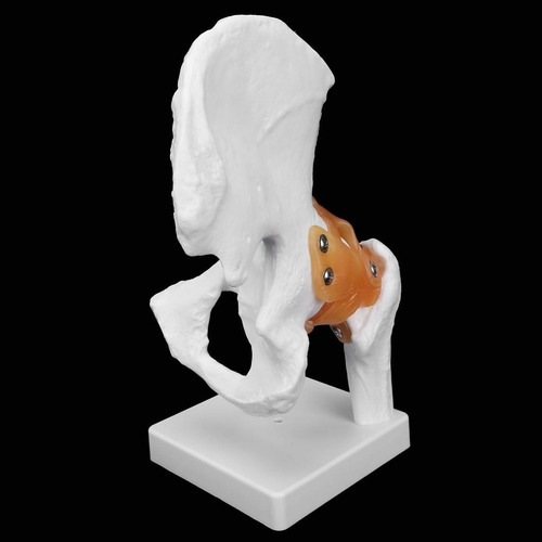 Imagen 2 de 7 de Modelo Articulación De Cadera
