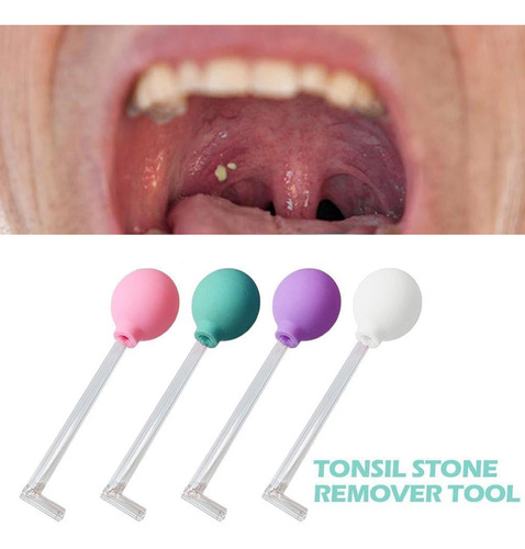 Tonsil Stone Remover Tool - Tonsil Stone Remover Vacuum Kit