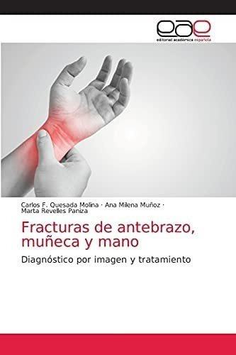 Libro: Fracturas Antebrazo, Muñeca Y Mano: Diagnóstico Po