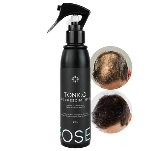 Tônico Poderoso Capilar Proself Masculino Para Crescer Fios