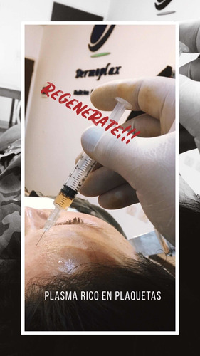 Imagen 3 de 3 de Plasma Rico En Plaquetas