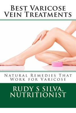 Libro Best Varicose Vein Treatments: Natural Remedies Tha...