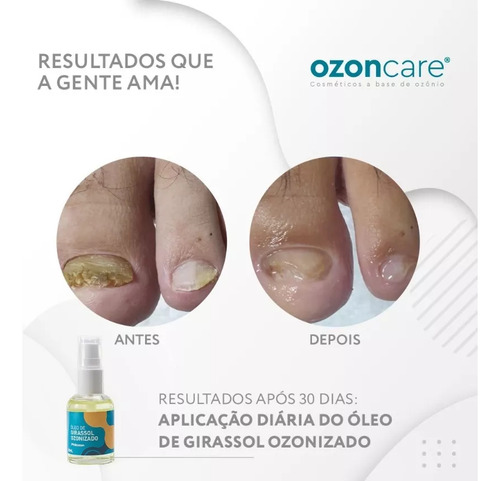 Óleo De Girassol Ozonizado / 30 ml Philozon