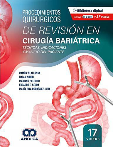 Procedimientos Quirúrg. Revisión Cirugía Bariátrica.-zundel