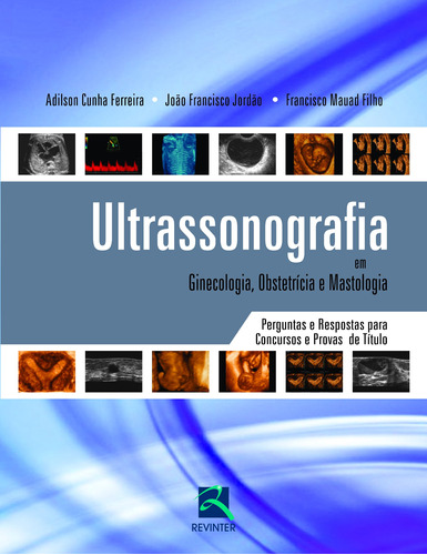 Ultrasonografia em Ginecologia, Obstetrícia e Mastologia, de Mauad, Francisco. Editora Thieme Revinter Publicações Ltda, capa mole em português, 2011