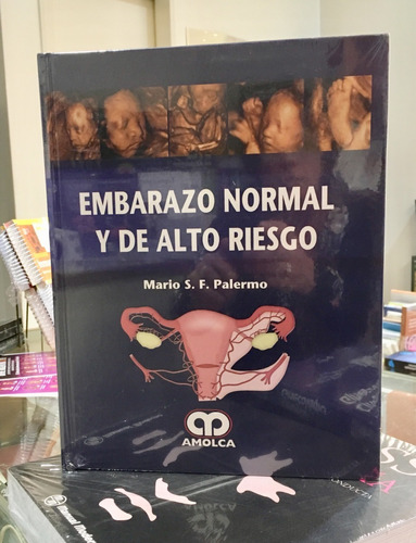 Embarazo Normal Y De Alto Riesgo Palermo