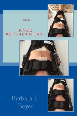 Libro Read This Before Your Knee Replacement - Boyer, Bar...