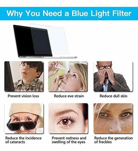 Imagen 5 de 7 de Filtro De Pantalla Anti Luz Azul Para Computadora Portátil D