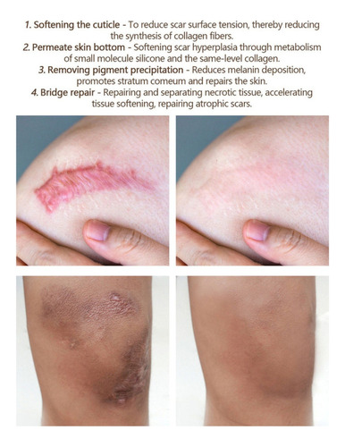 - Removemos Cicatrizes De Acne, Reparamos E Tratamos
