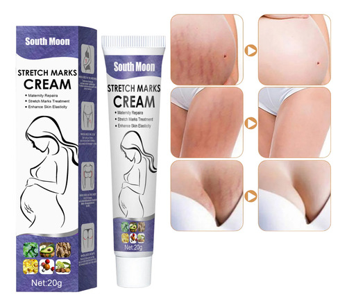 South Moon Stretch Mark Reparador Crema Para Estrías, Cicatr