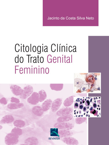 Citologia Clínica Do Trato Genital Feminino, De Jacinto Da Costa Silva. Editora Revinter, Capa Mole Em Português