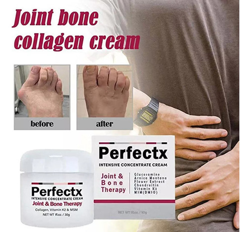 Crema Terapéutica Perfectx Para Articulaciones Y Huesos, 2 U