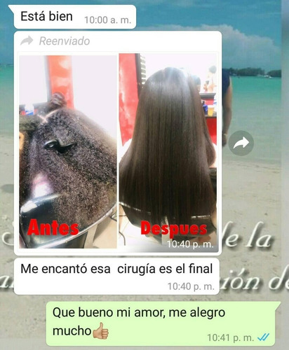 Imagen 1 de 5 de Cirugía Capilar, El Mejor Tratamiento Para Tu Cabello.