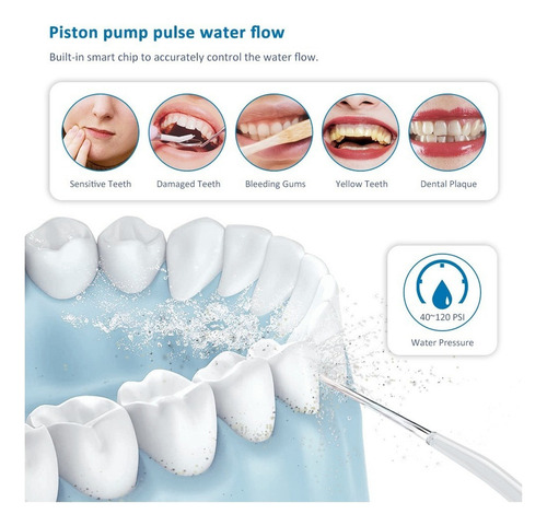 Irrigador Dental Usb Ultra Oral Portátil Waterflosser 2022
