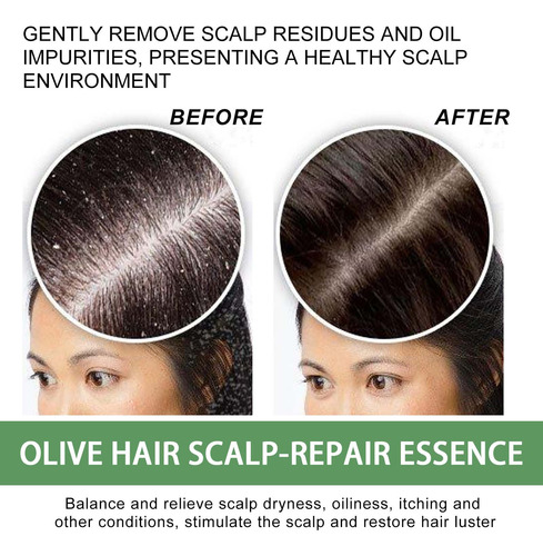 Olive Scalp Repair Alivia A Vermelhidão E A Coceira Do Couro