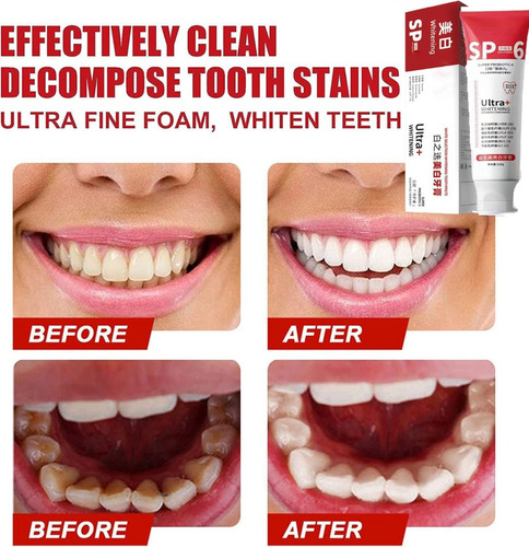 Zh Sp-6 Probiotics Pasta Blanqueadora Dientes Aliento Fresco