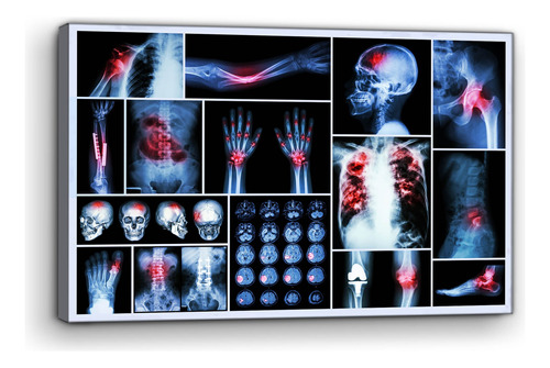Cuadro Moderno Canvas Radiografia Partes Del Cuerpo 90x140cm