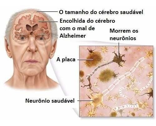 Imagem 2 de 4 de Coenzima Co Q10 100 Mg 240 Capsulas Original 4 Potes