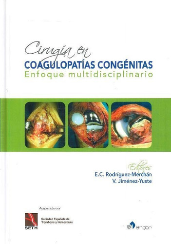 Libro Cirugía En Coagulopatías Congénitas De E. C. Rodriguez