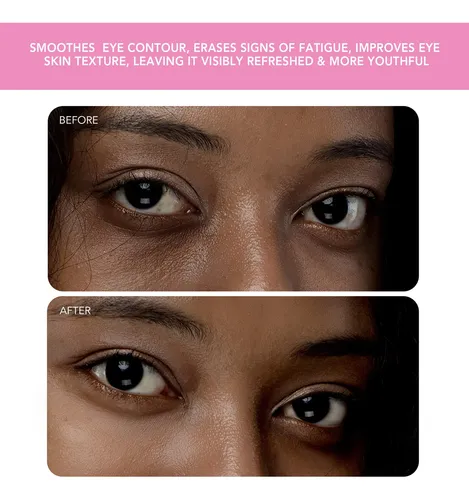 Masajeador De Ojos Foreo Iris 2 Con Drenaje Linfático, Color