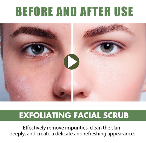 Esfoliante Facial Esfoliante Esfoliante Natural Esfoliante F