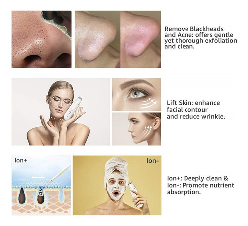 Esfoliador De Pele Ultra-sônico Espátula Limpieza Facial