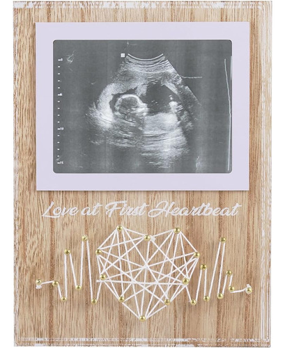 Elekfx New Mom Gifts - Anuncios De Embarazo Ideas Baby Gende