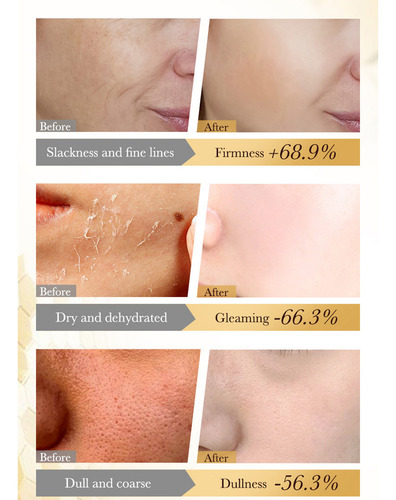 Y Máscara Anti-rugas E Reafirmante Creme Hidratante 65g 2001