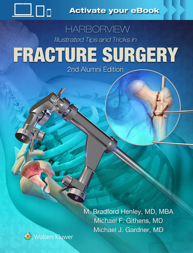 Consejos Y Trucos Ilustrados De Harborview En Ciruga De Frac