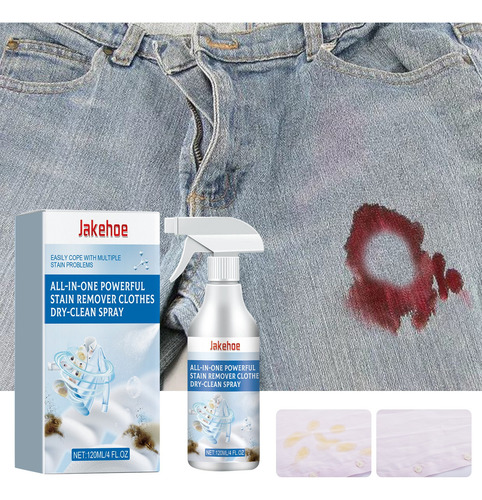 L Potente Spray De Limpeza A Seco Para Remover Manchas. Manc