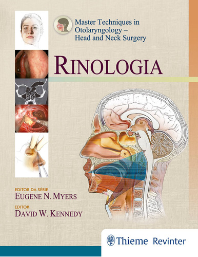 Rinologia: Master Techniques In Otolaryngology - Head And Neck Surgery, de Kennedy, David W.. Editora Thieme Revinter Publicações Ltda, capa dura em português, 2017