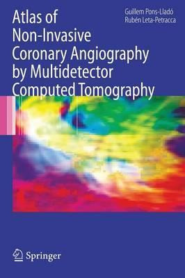 Libro Atlas Of Non-invasive Coronary Angiography By Multi...