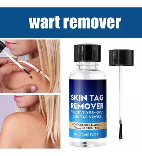 Nitrógeno Líquido Antiwart, Eliminador De Moho, 2 Unidades