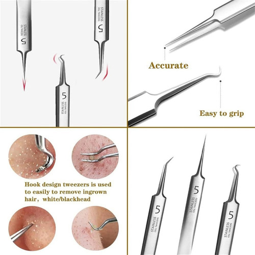 - Pinzas For Puntos Negros, Pinzas De Acero Inoxidable