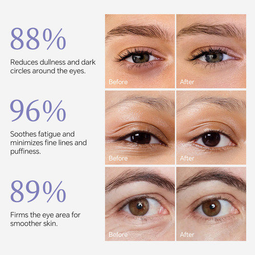 O Creme Corretivo De Olhos S Retinol Firma A Área Dos Olhos