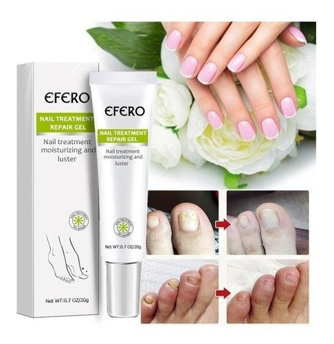 Imagen 4 de 6 de Gel De Uñas Efero De 7 Piezas, Tratamiento Eficaz Para Mi