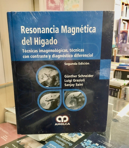 Resonancia Magnética Del Hígado 2 Da Ed.