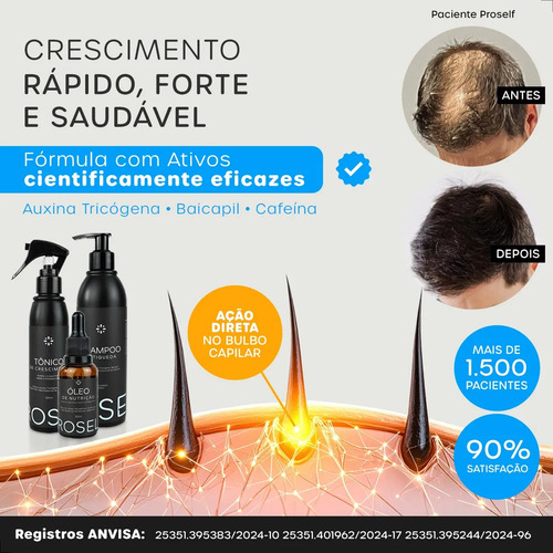 Tônico Capilar Natural Proself Vegano Crescimento E Volume