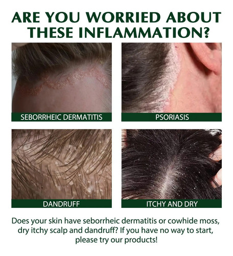 Shampoo Anti-coceira Scalp Seborreic Hair Shampoo Cream Rem