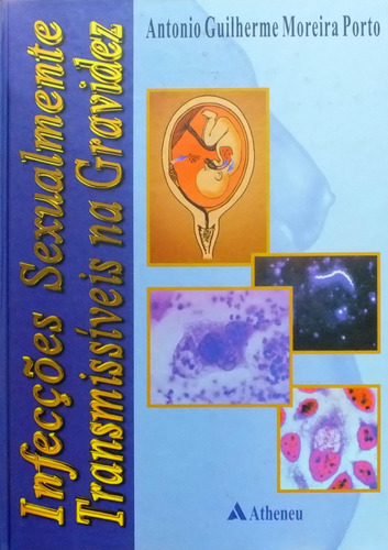Infecções sexualmente transmissíveis na gravidez, de Porto, Antônio Guilherme Moreira. Editora Atheneu Ltda, capa mole em português, 2001